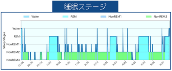 睡眠ステージ・睡眠経過図