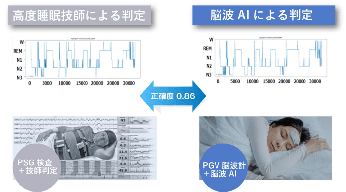 技師と睡眠脳波AIの精度の比較